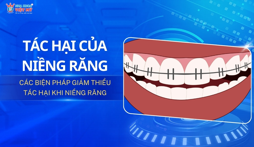 thumbnail tác hại của niềng răng