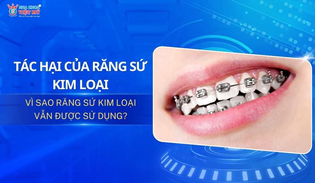 thumbnail tác hại của răng sứ kim loại