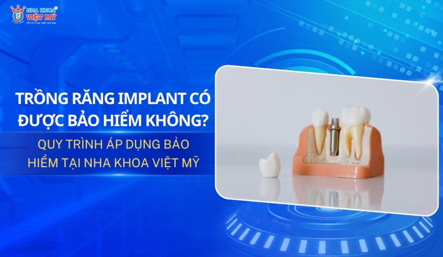 thumbnail trồng răng implant có được bảo hiểm không