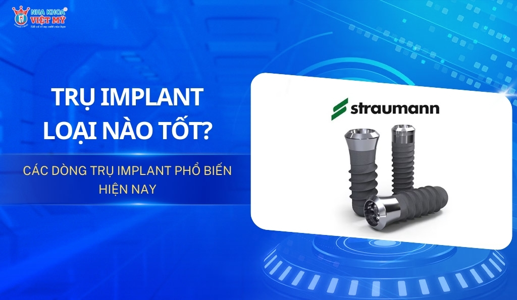 Trụ Implant nào tốt? Các dòng phổ biến hiện nay