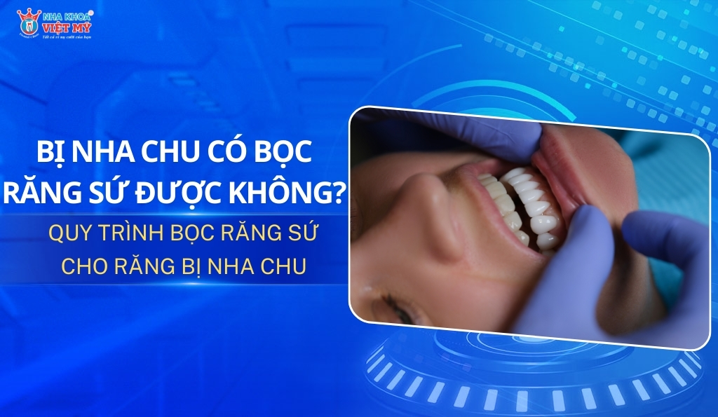 thumbnail bị nha chu có bọc răng sứ được không