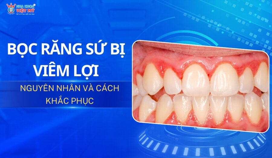 thumbnail bọc răng sứ bị viêm lợi