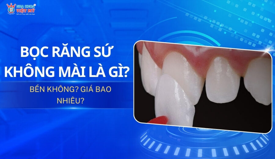 thumbnail bọc răng sứ không mắc cài