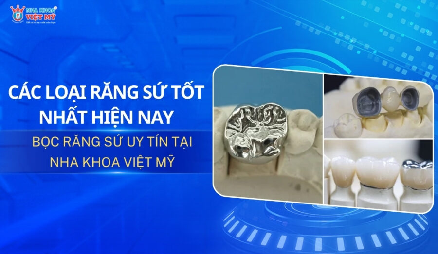 thumbnail các loại răng sứ tốt nhất hiện nay