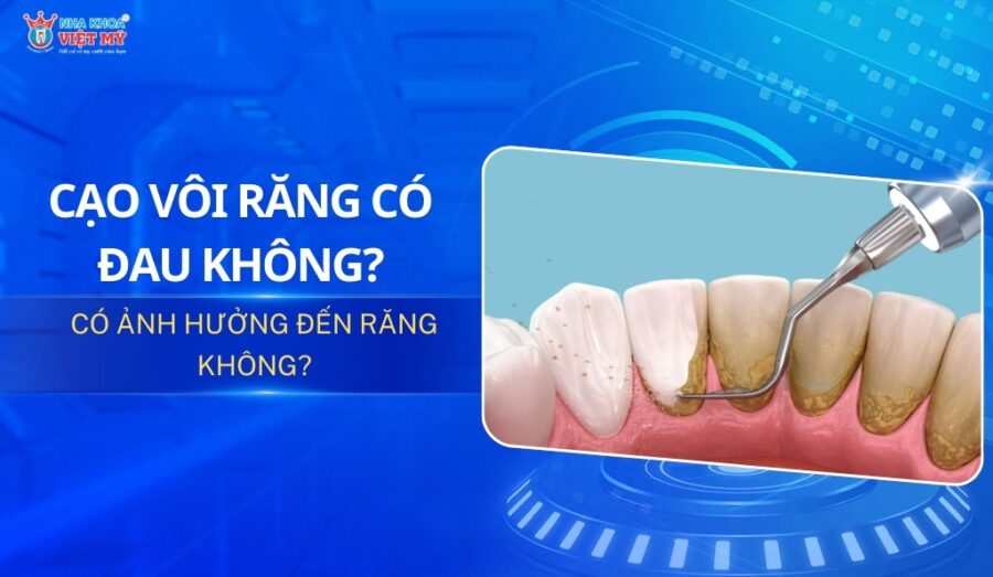 thumbnail cạo vôi răng có đau không