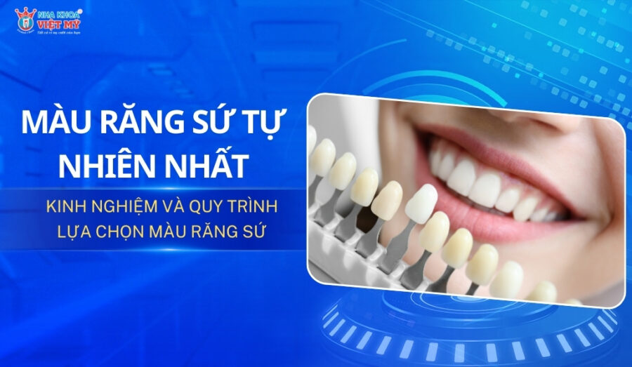 thumbnail màu răng sứ tự nhiên nhất