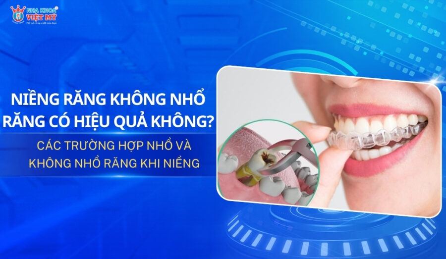 thumbnail niềng răng không nhổ răng có hiệu quả không