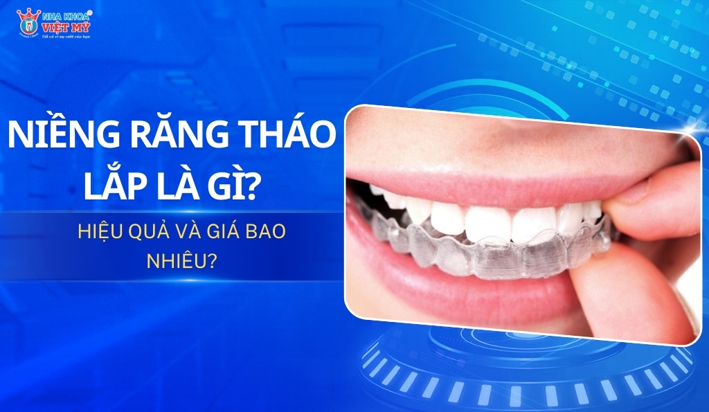 thumbnail niềng răng tháo lắp