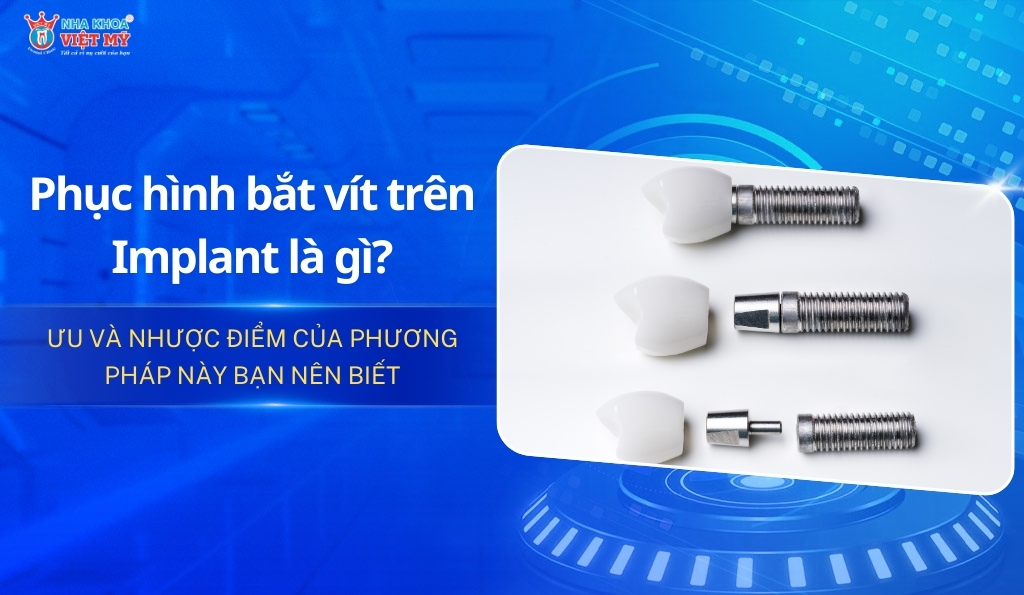 Phục hình bắt vít trên Implant là gì? Ưu và nhược điểm