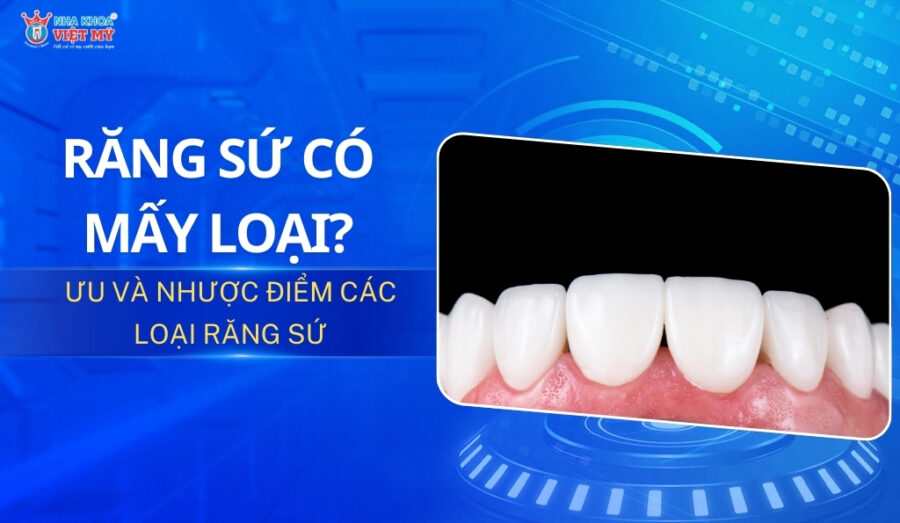 thumbnail răng sứ có mấy loại