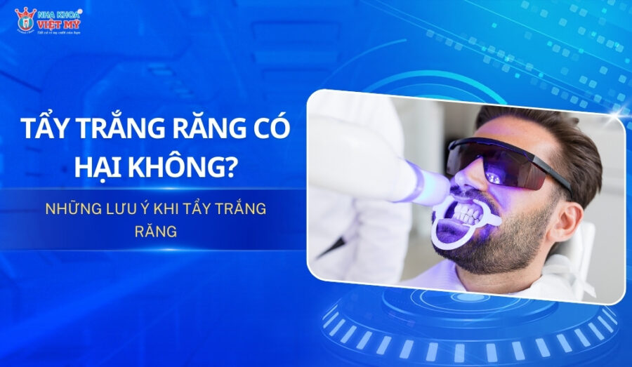 Tẩy trắng răng có hại không? Những lưu ý khi tẩy trắng răng