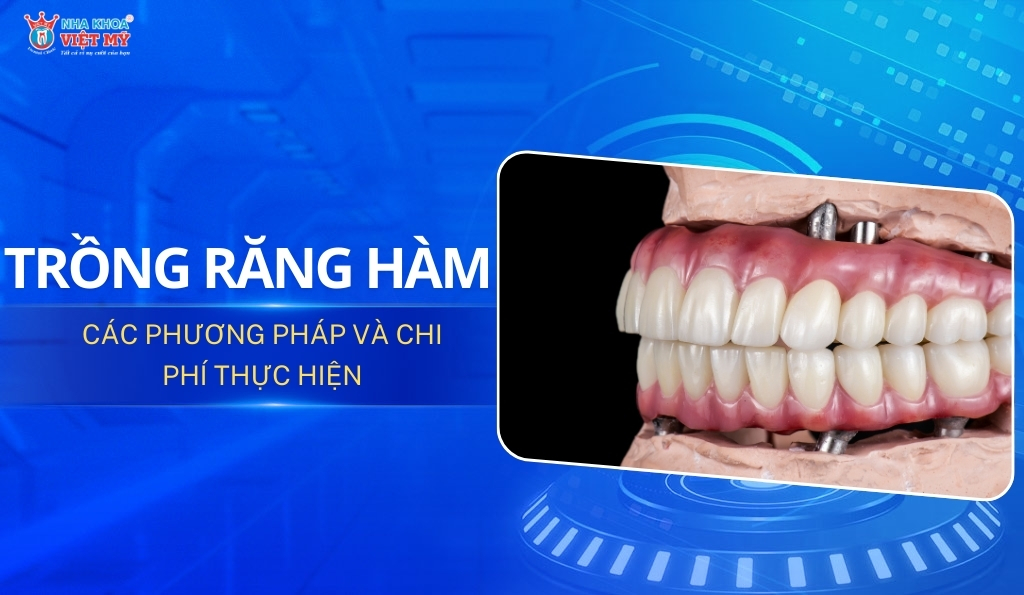 thumbnail trồng răng hàm