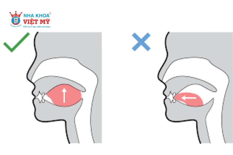 Nên thực hiện các bài tập há miệng để mang lại kết quả tốt