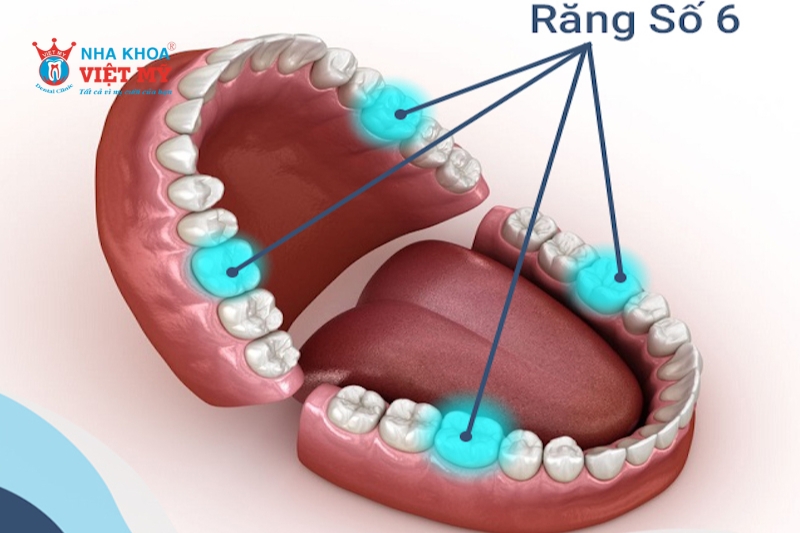 Răng số 6 trải qua nhiều giai đoạn lành thương sau khi nhổ