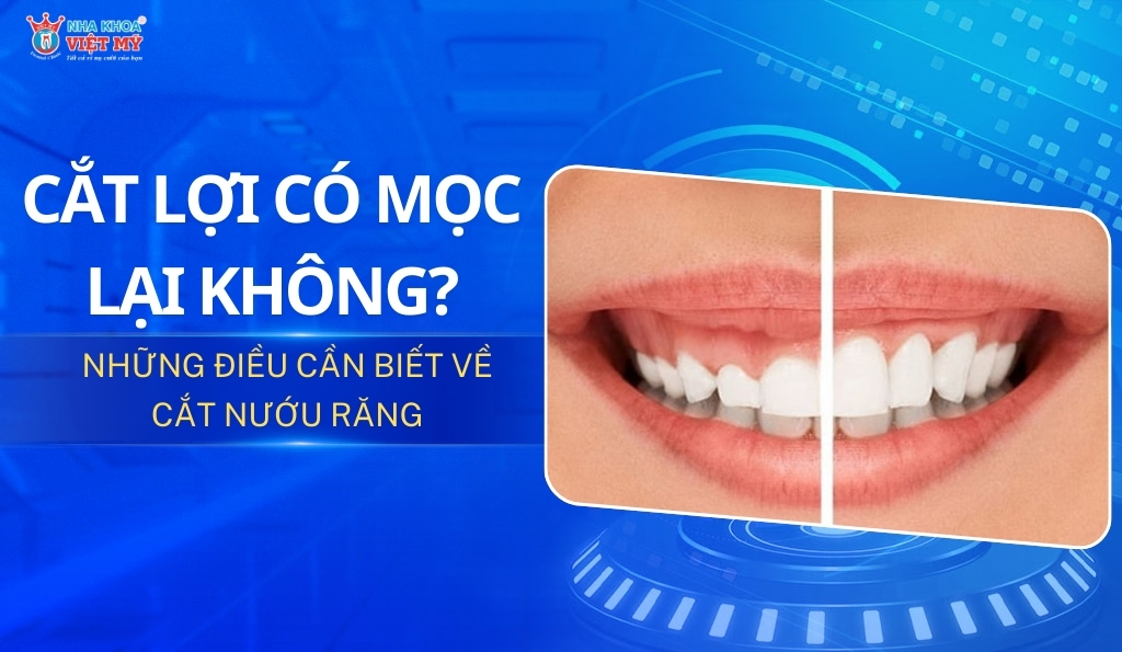 thumbnail cắt lợi có mọc lại không