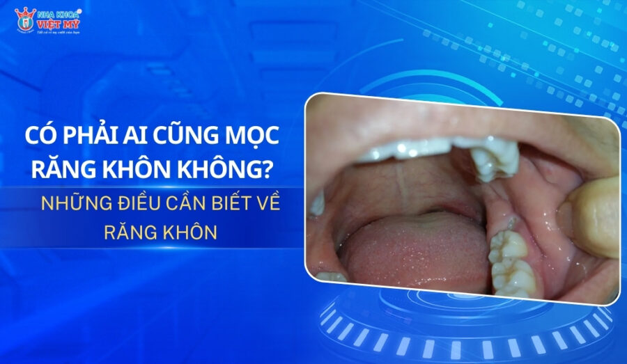 thumbnail có phải ai cũng mọc răng khôn không