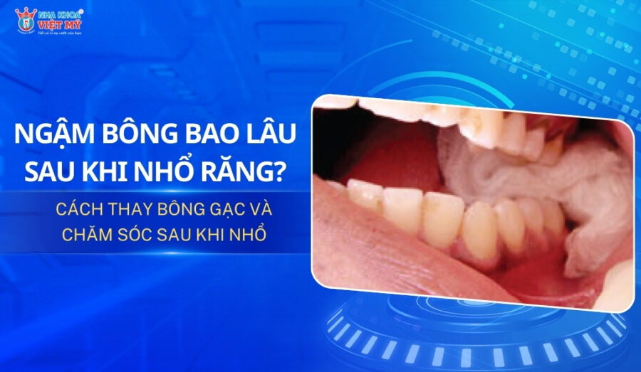 thumbnail ngậm bông bao lâu sau khi nhổ răng