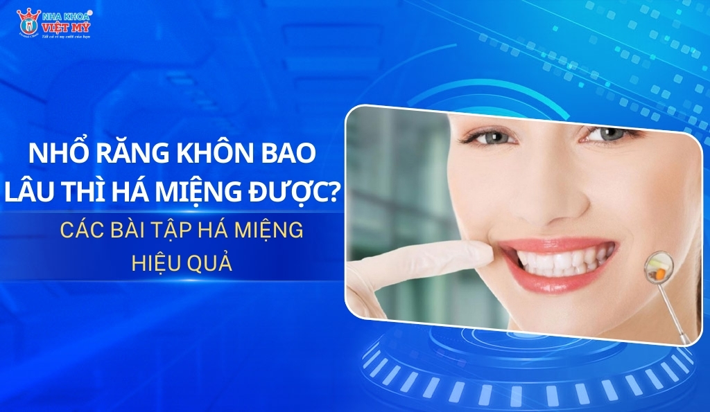 thumbnail nhổ răng khôn bao lâu thì há miệng được