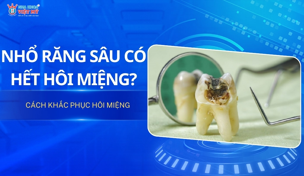 thumbnail nhổ răng sâu có hết hôi miệng