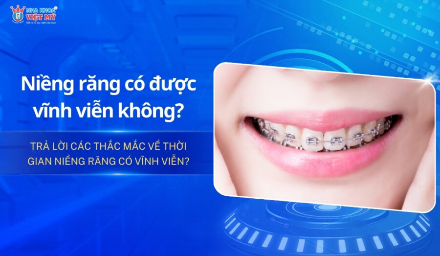 thumbnail niềng răng có được vĩnh viễn không