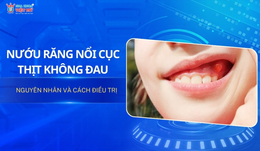 thumbnail nướu răng nổi cục thịt không đau