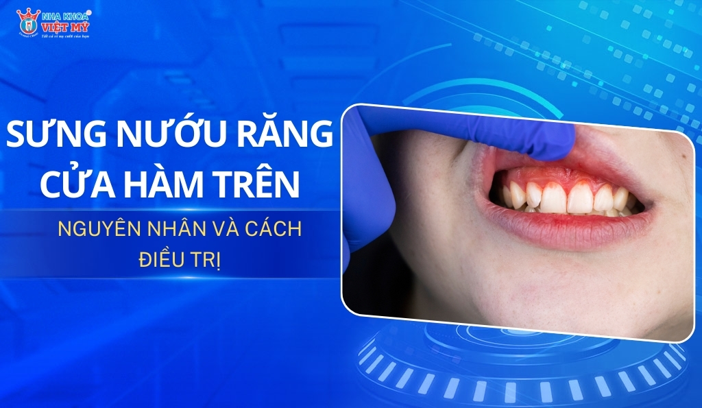 thumbnail sưng nướu răng cửa hàm trên