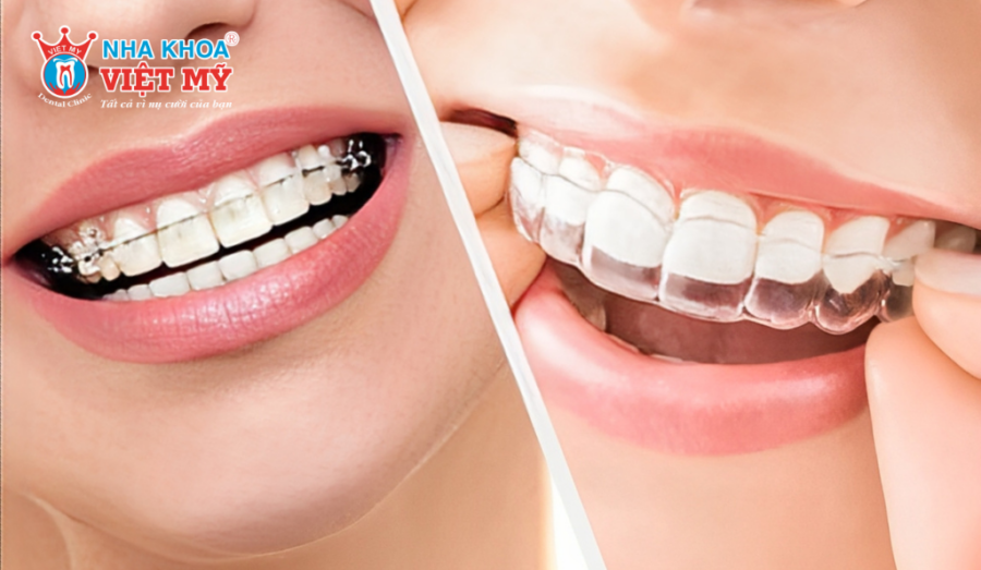8 popular dental services in Vietnam