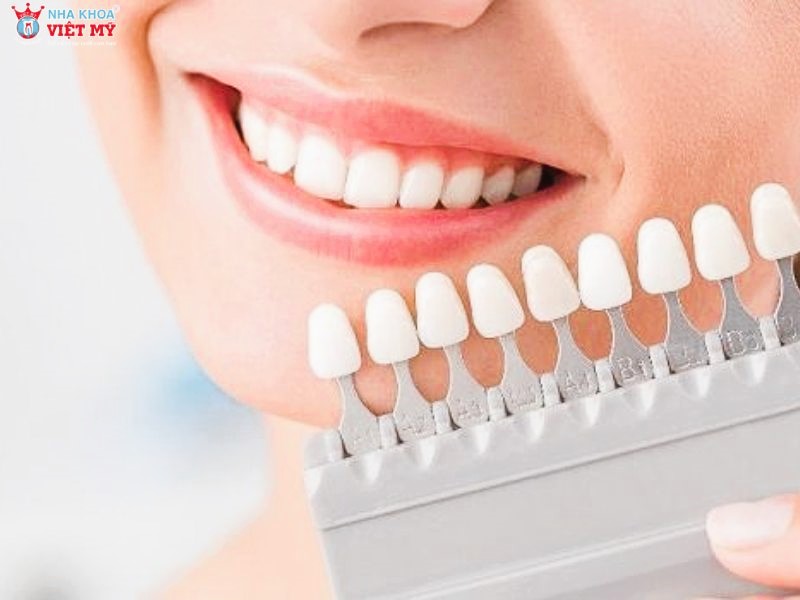 Nên lựa chọn địa chỉ uy tín và có giá bọc răng sứ hợp lý