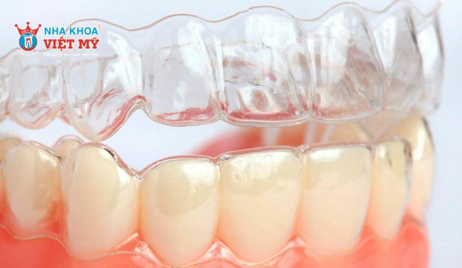 Niềng răng trong suốt Zenyum sử dụng công nghệ hiện đại