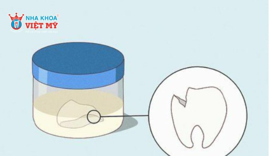 Giữ lại các mảnh răng vỡ để bác sĩ gắn chúng lại