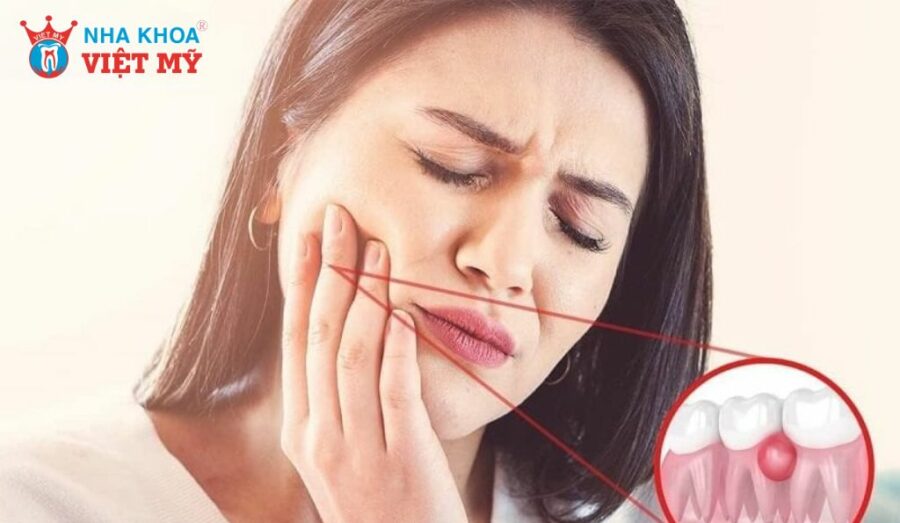 Liệt kê những cách trị mủ chân răng tại nhà cực hiệu quả, dễ làm