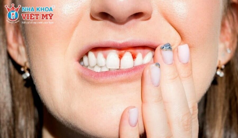 Biện pháp phòng tránh viêm mủ chân răng tại nhà