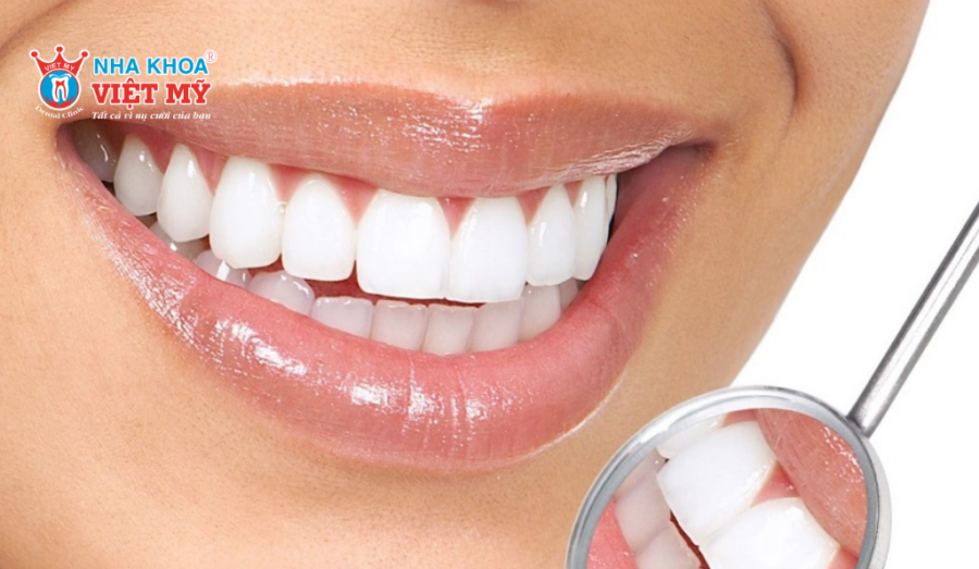 Bọc răng toàn sứ không xỉn màu nếu được chăm sóc đúng cách