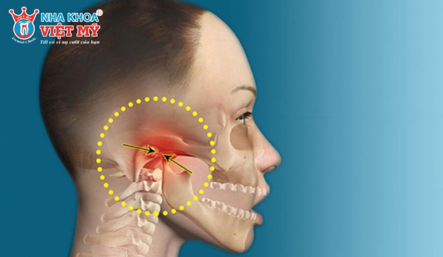Nhai nhiều 1 bên thì bên nào to hơn?