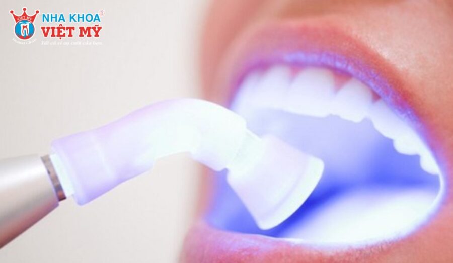 Phương pháp tẩy trắng răng được thực hiện như thế nào?