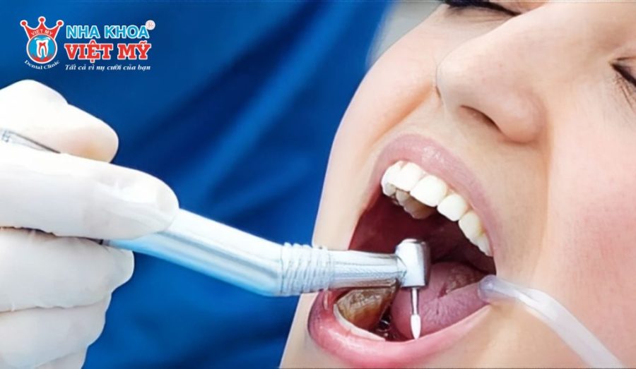 Phương pháp điều trị khi bị áp xe ở răng