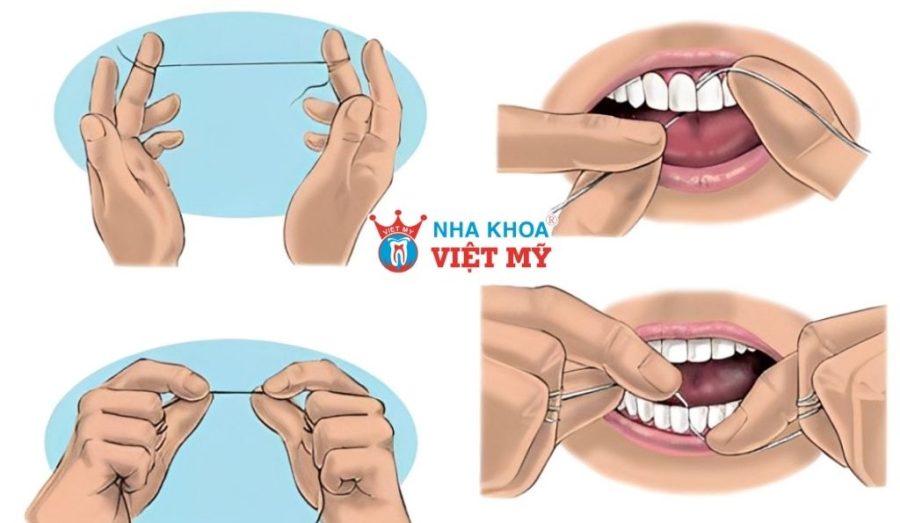 Cách sử dụng chỉ nha khoa dạng cuộn