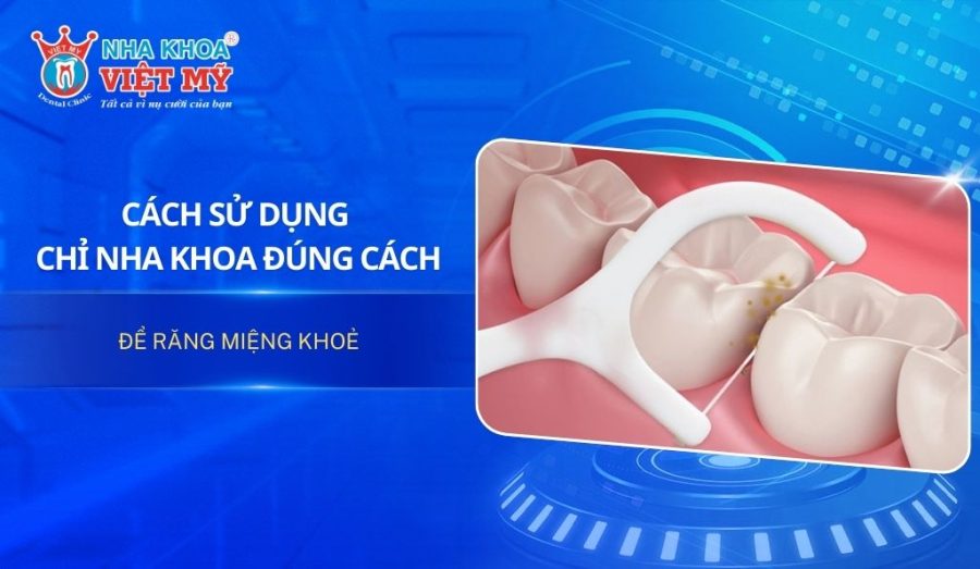 Cách sử dụng chỉ nha khoa