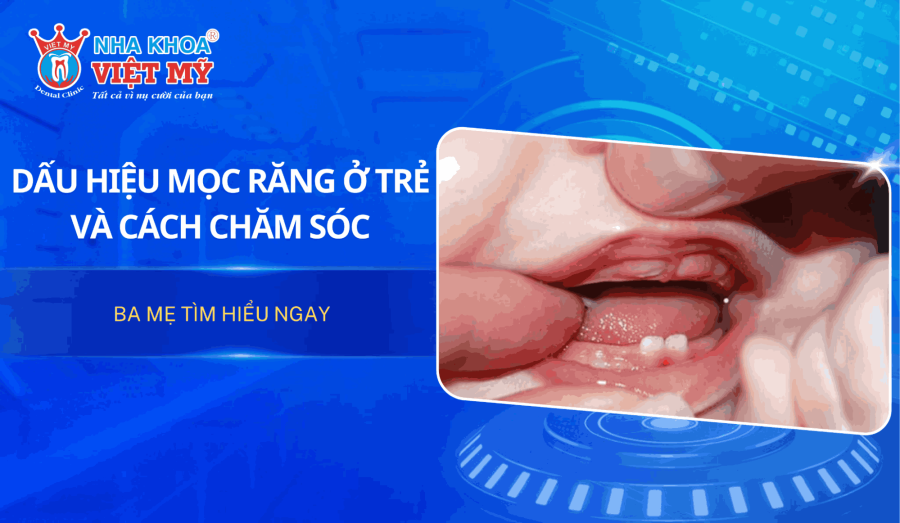Dấu hiệu trẻ mọc răng