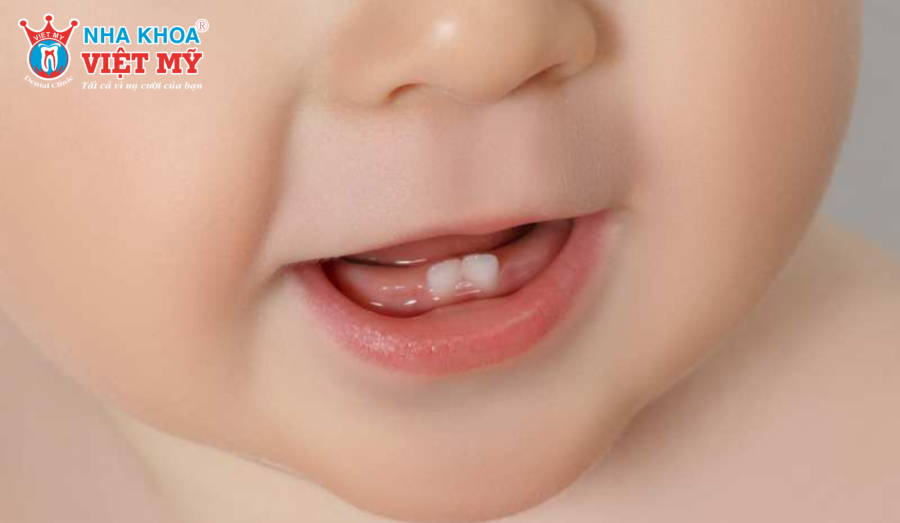 Khi nào trẻ bắt đầu mọc răng?