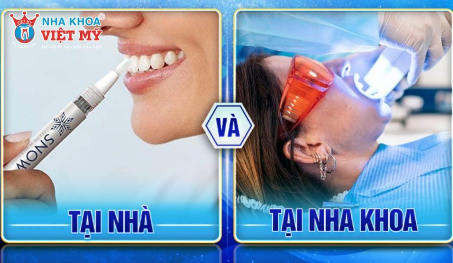 Công nghệ ảnh hưởng đến giá làm trắng răng
