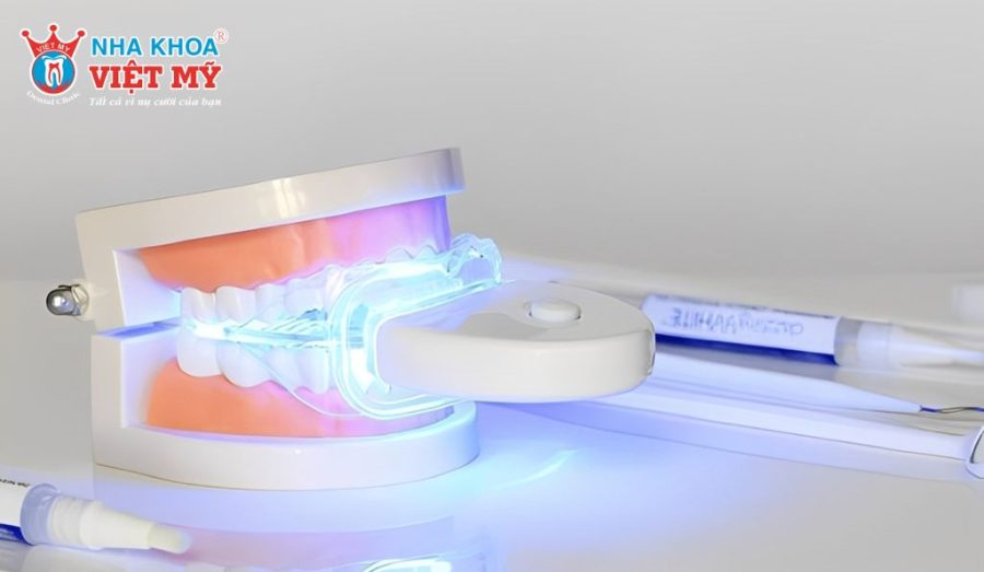Câu hỏi thường gặp về dịch vụ làm trắng răng tại Nha khoa Việt Mỹ