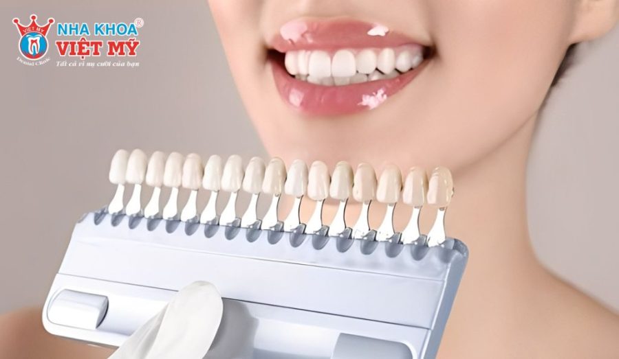Lưu ý khi thực hiện tẩy trắng răng