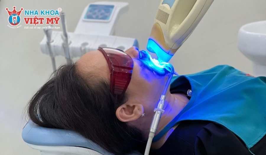 Dịch vụ tẩy trắng răng bằng công nghệ LED Bleaching