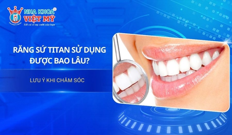 Răng sứ Titan sử dụng được bao lâu? Lưu ý khi chăm sóc