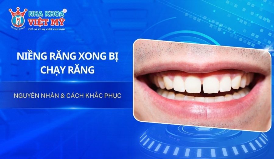 Niềng răng xong bị chạy răng: Nguyên nhân & cách khắc phục
