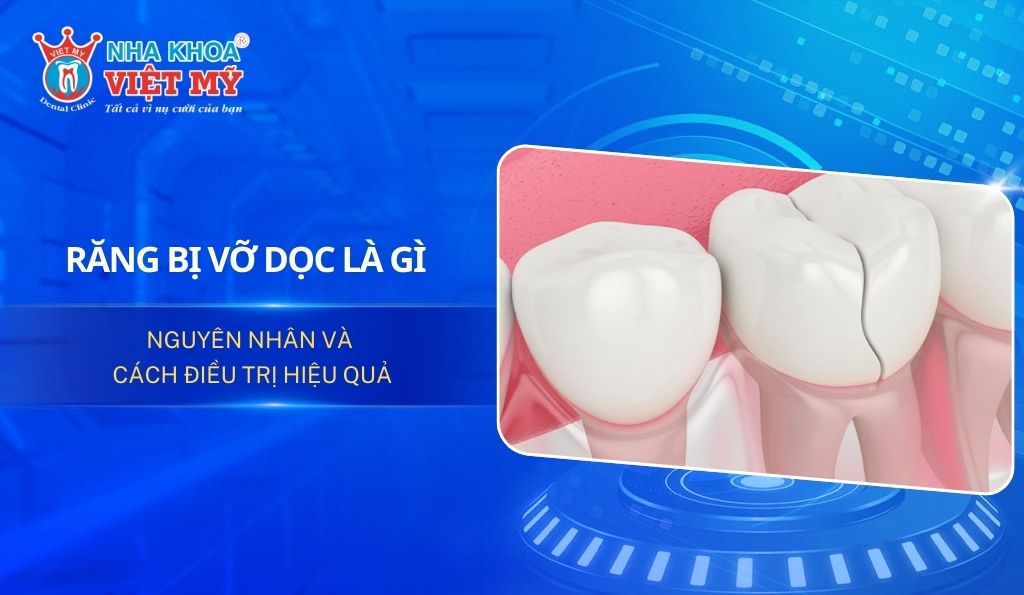 Răng bị vỡ dọc là gì? Nguyên nhân và cách điều trị hiệu quả
