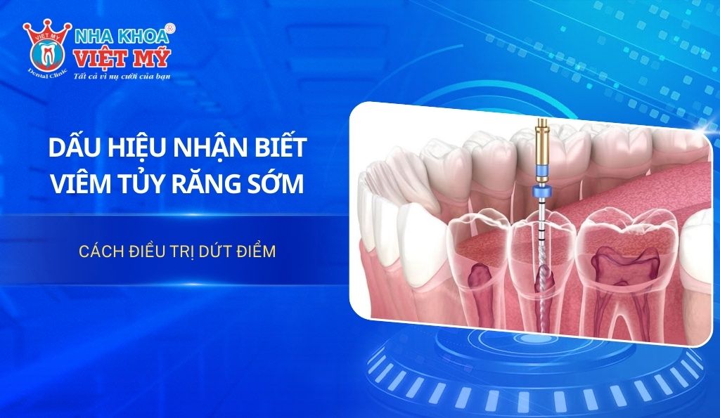 Dấu hiệu nhận biết viêm tủy răng sớm và cách điều trị dứt điểm