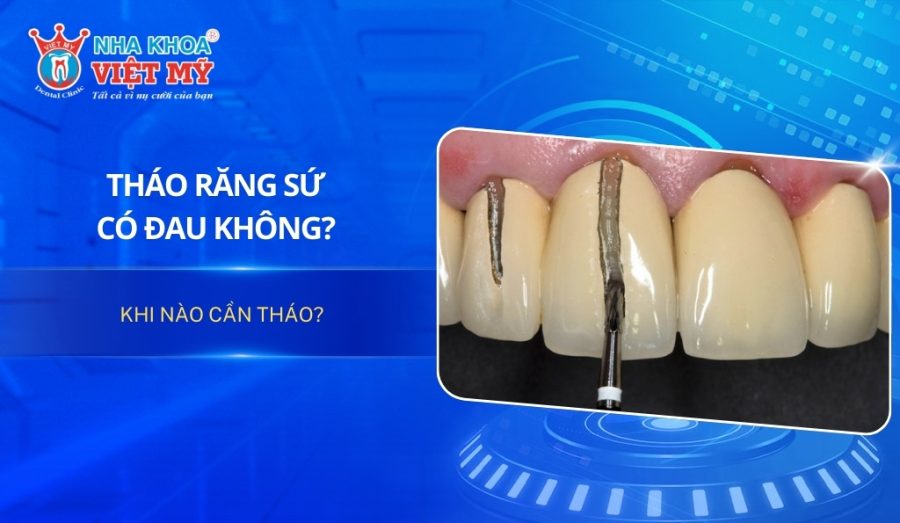 Tháo răng sứ có đau không? Khi nào cần tháo