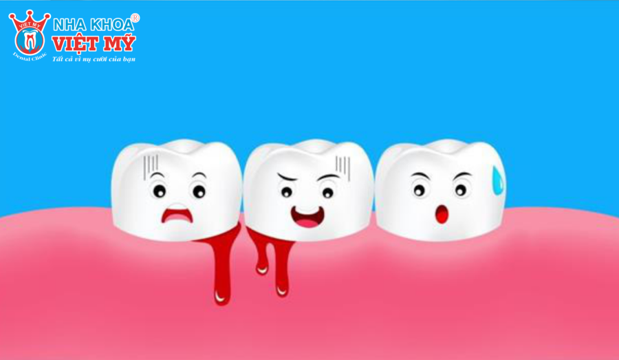 Nguyên nhân gây chảy máu chân răng là gì?